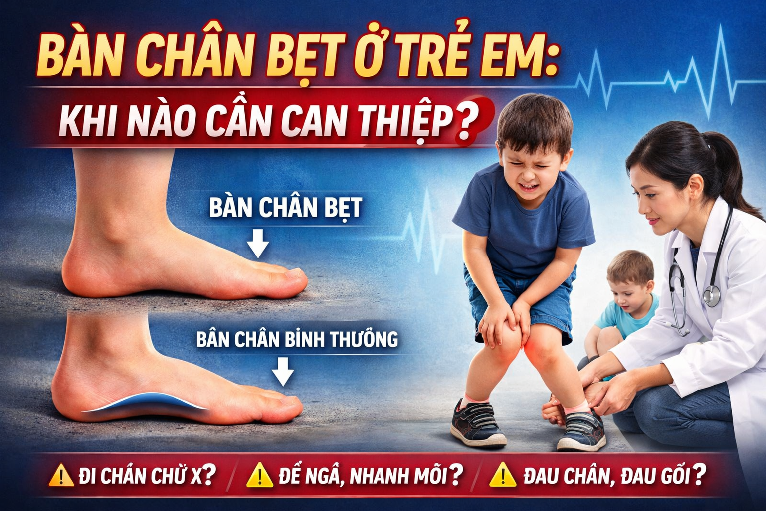 BÀN CHÂN BẸT TRẺ EM, KHI NÀO CẦN CAN THIỆP?